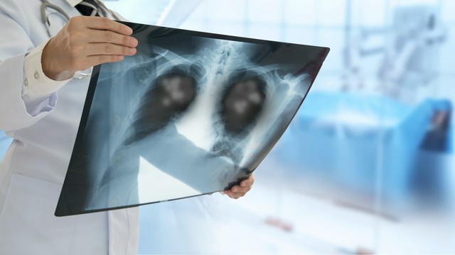 lekarz ogląda zdjęcie rentgenowskie